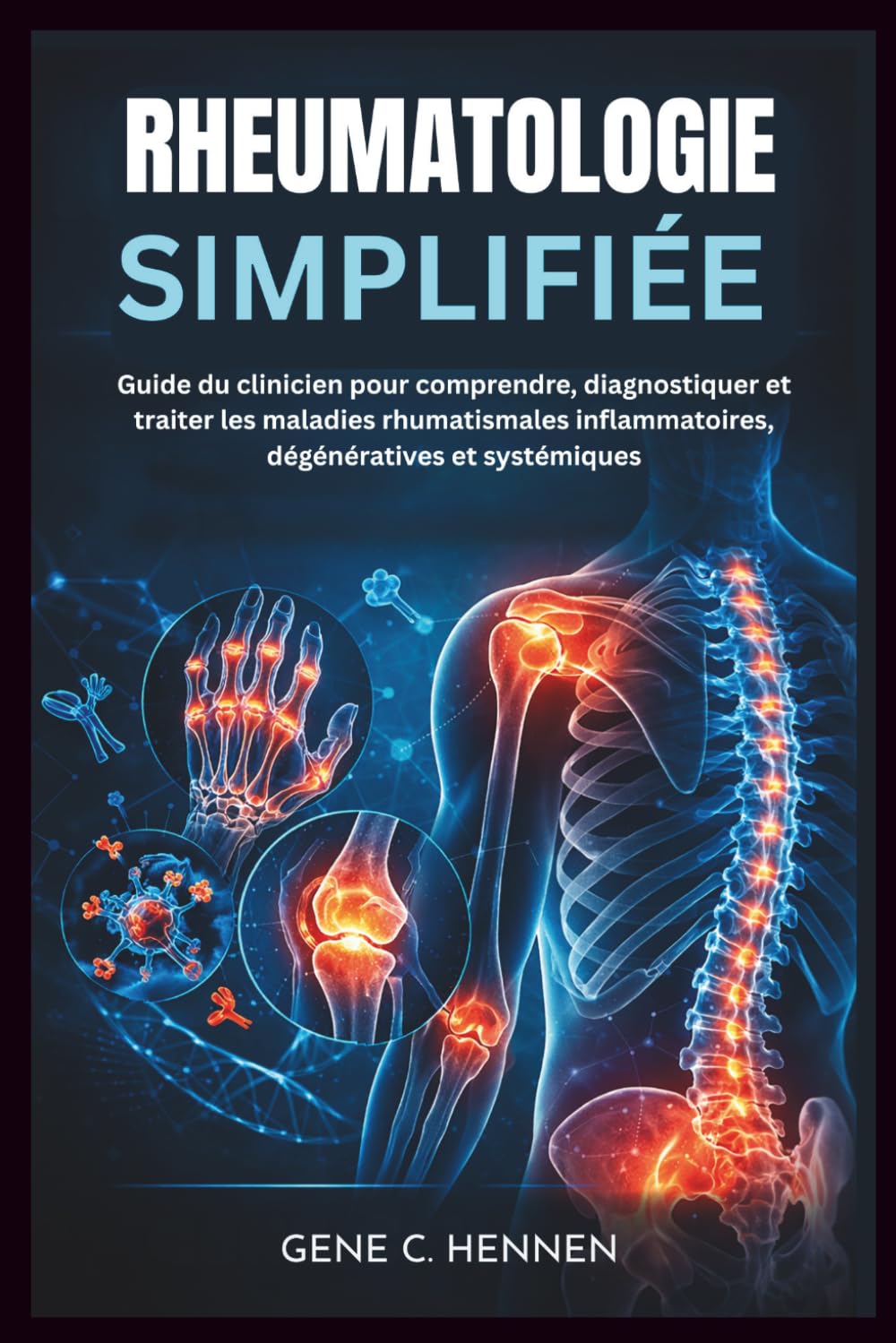 RHEUMATOLOGIE SIMPLIFIÉE: Guide du clinicien pour comprendre, diagnostiquer et traiter les maladies rhumatismales inflammatoires, dégénératives et systémiques