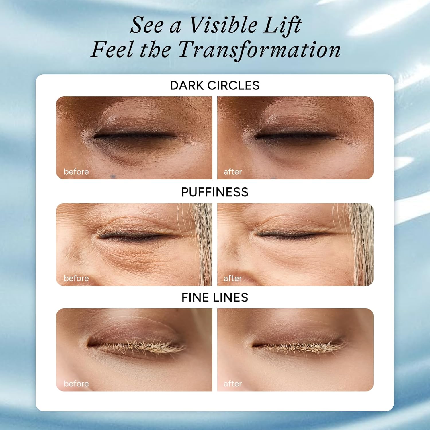 In My Eyes Hydrating Under Eye Patches 5 Pairs - Hyaluronic Acid Hydrogel Eye Masks, Depuffing Anti-Wrinkle for Dark Circles Fine Lines Puffiness, Self Care Gifts for Women & Teenage Girls - Image 5