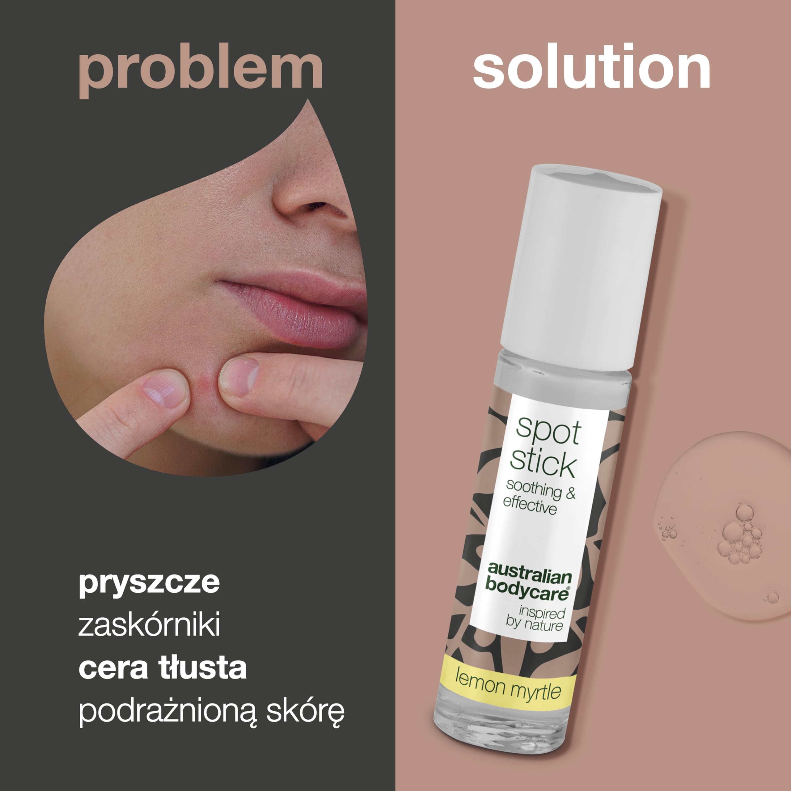 Australian Bodycare Spot Stick 9ml | Roll-on na niedoskonałości skóry | Działa kojąco i oczyszczająco na pryszcze, zaskórniki i inne wypryski | Z 100% naturalnym Olejkiem z Drzewa Herbacianego