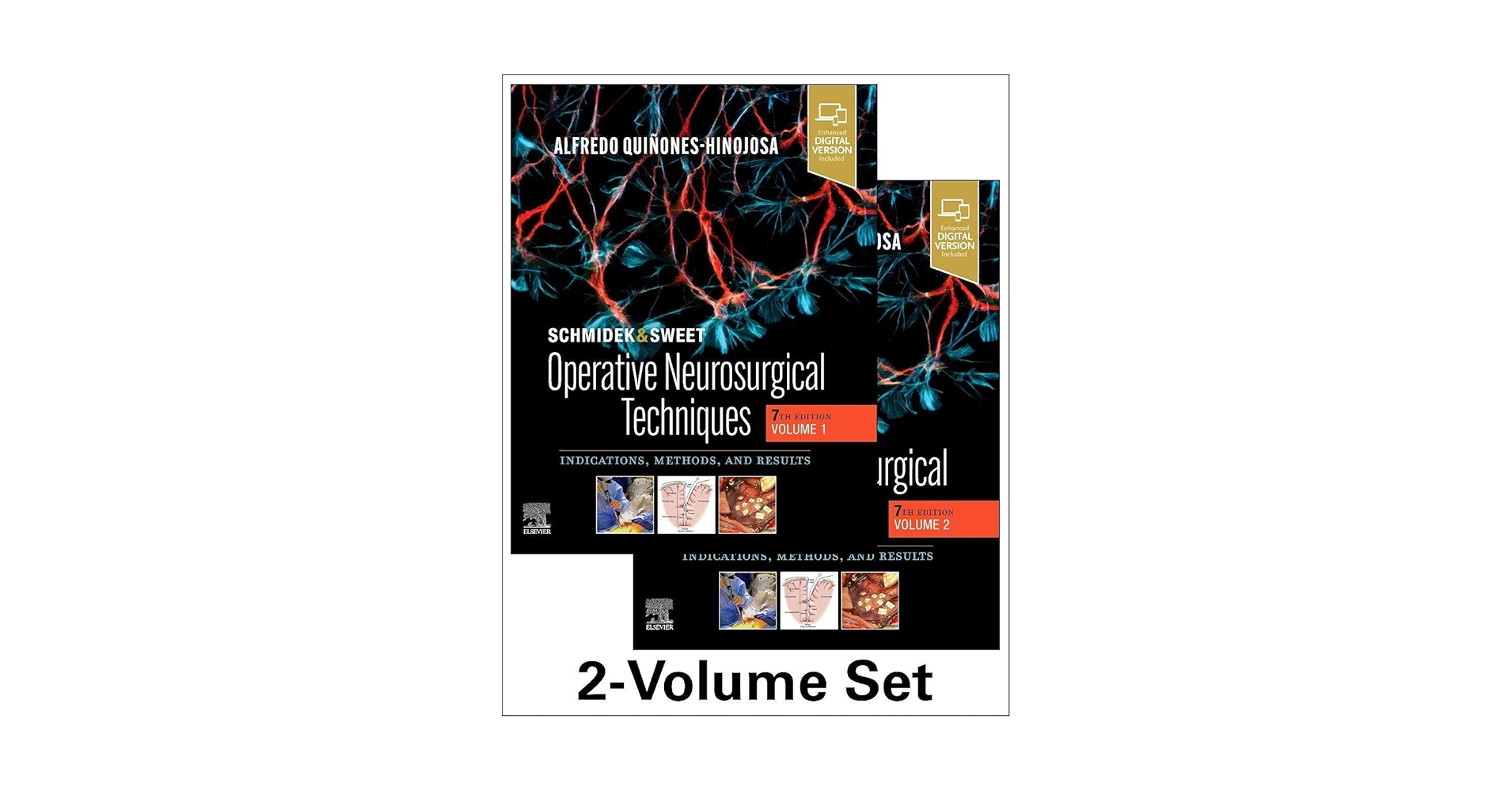 Schmidek and Sweet: Operative Neurosurgical Techniques 2