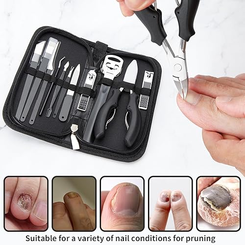 Miniatura 3 de Cortaúñas encarnadas, 11 unidadesjuego de herramientas de tratamiento de uñas, cuchillo de pedicura, cortador de cutículas, kit de manicura para el