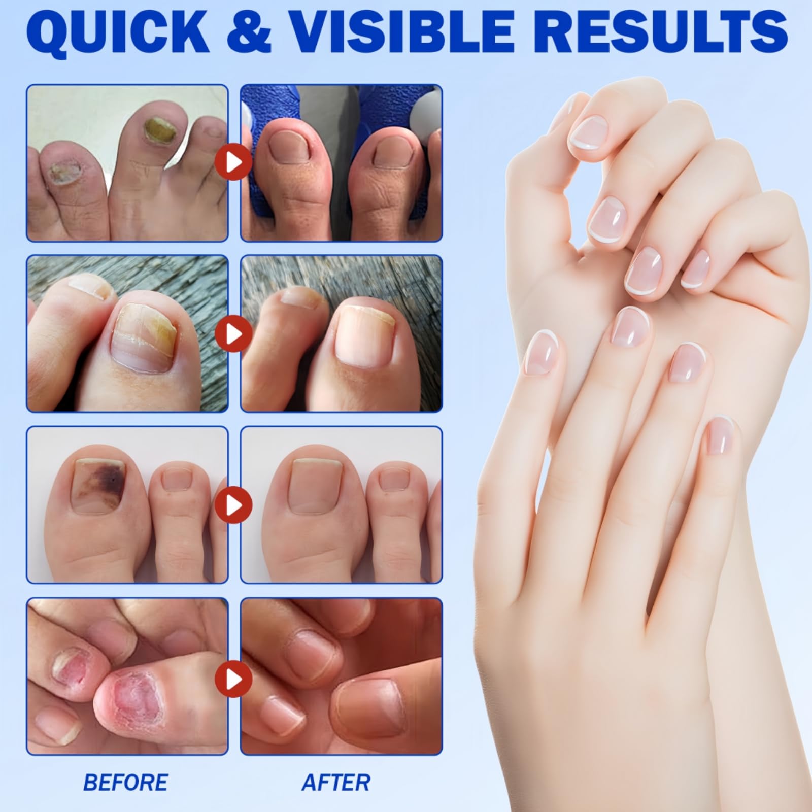 21 Pcs Fungal Nail Treatment Patches, Toenail Repair Pads for Targeted Relief, Antifungal Nail Treatment for Toenails - Image 3