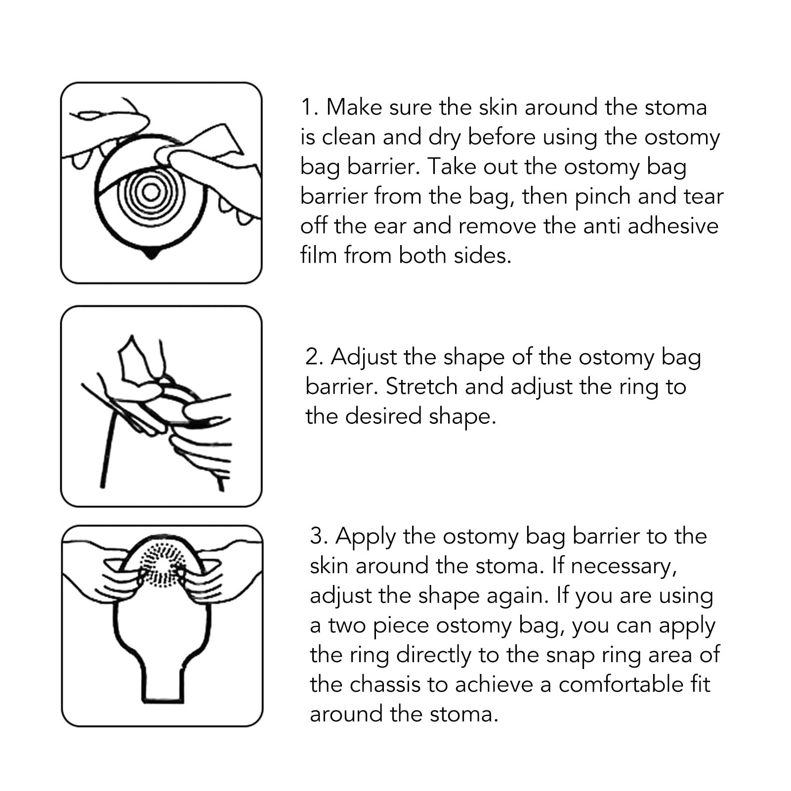 10 Stück Ostomie-Barriere-Ringe, Ostomie-Tasche, Hautbarriere, Silikon, formbar, auslaufsicher, Hautschutz, Kolostomie-Tasche, Hautbarriere