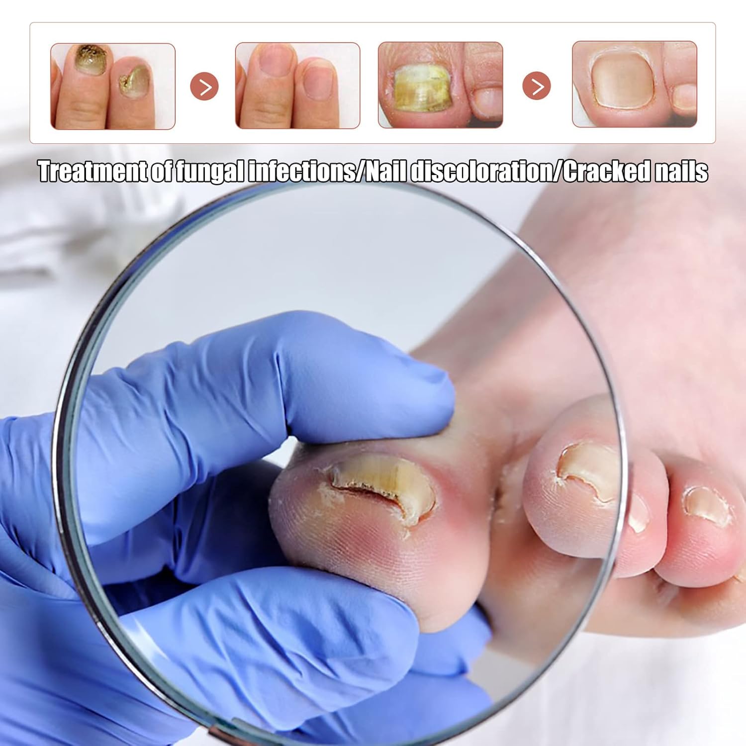Kerassentials Toenail Fungus Treatment Oil Supports Strong Healthy Natural Repair Nails (1pcs) : Health & Household