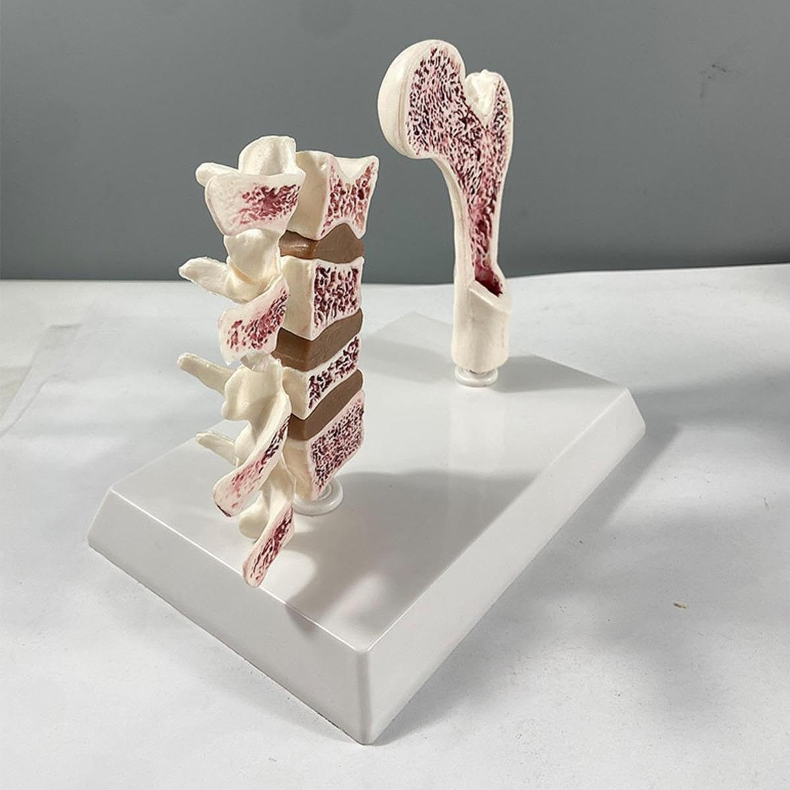 Modelo Portátil de Fémur Humano con Osteoporosis, Esqueleto Educativo con Vértebras, Kit de Aprendizaje de Material de PVC, Adecuado para La