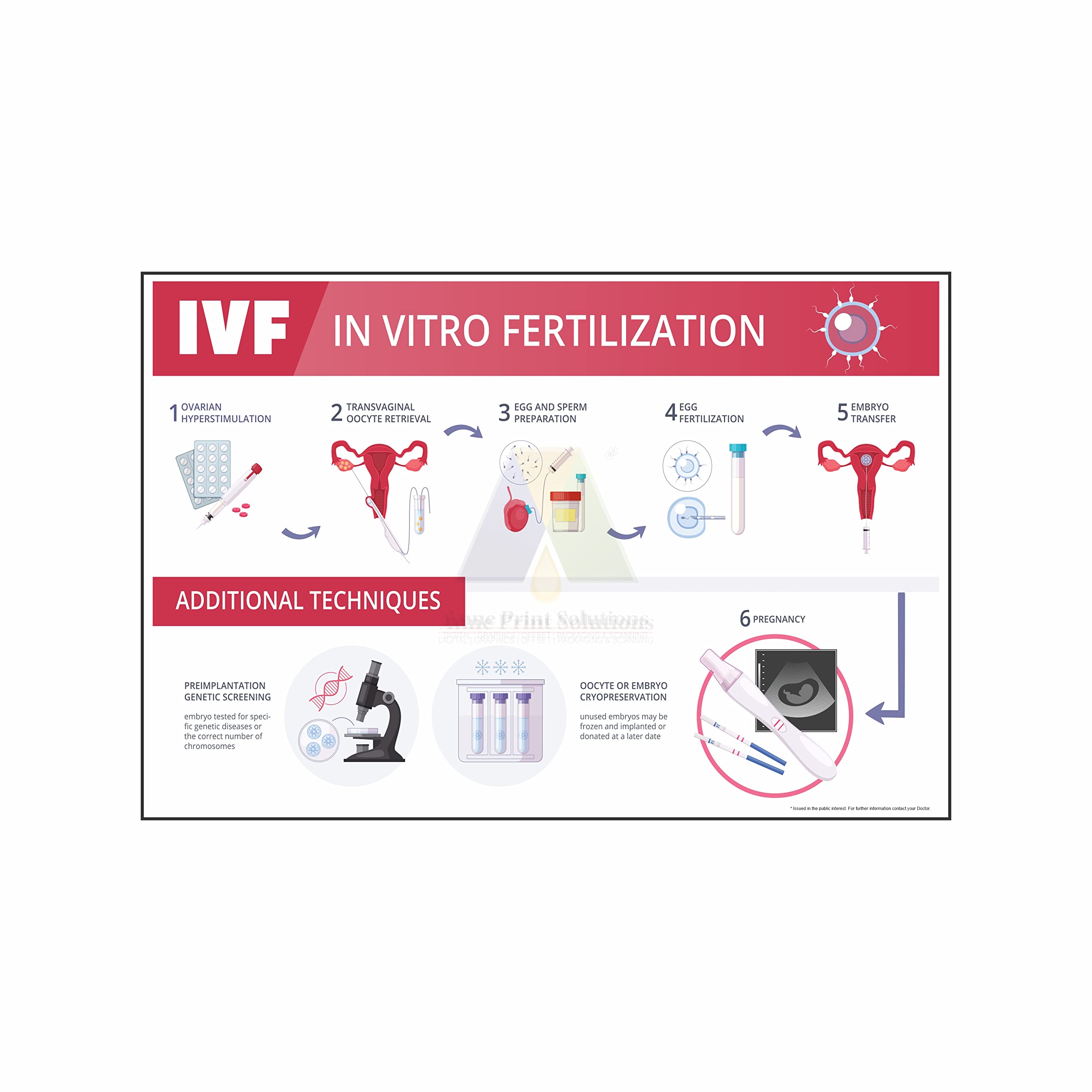Anne Print Solutions® IVF in vitro Fertilization Vinyl Sticker (Without Frame) for Hospital Stickers Nursing Home Stickers Printed On Non Tearable Vinyl Pack of 1 Pcs Size 24 Inch X 36 Inch*
