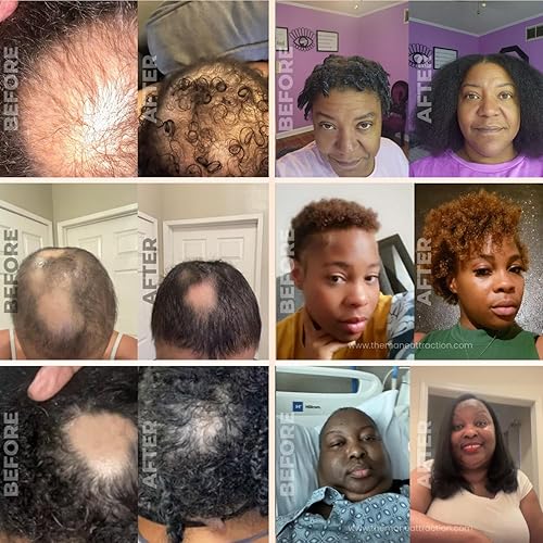 Miniatura 5 de The Mane Attraction Aceite de crecimiento de hierbas de romero + fenogreco extra fuerte Infundido con aceite de ricino para todo tipo de cabello