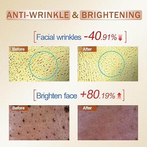 Miniatura 2 de Suero de vitamina C para rostro con ácido hialurónico, aumenta el colágeno de la piel, iluminador, antioxidante, antienvejecimiento, hidrata y