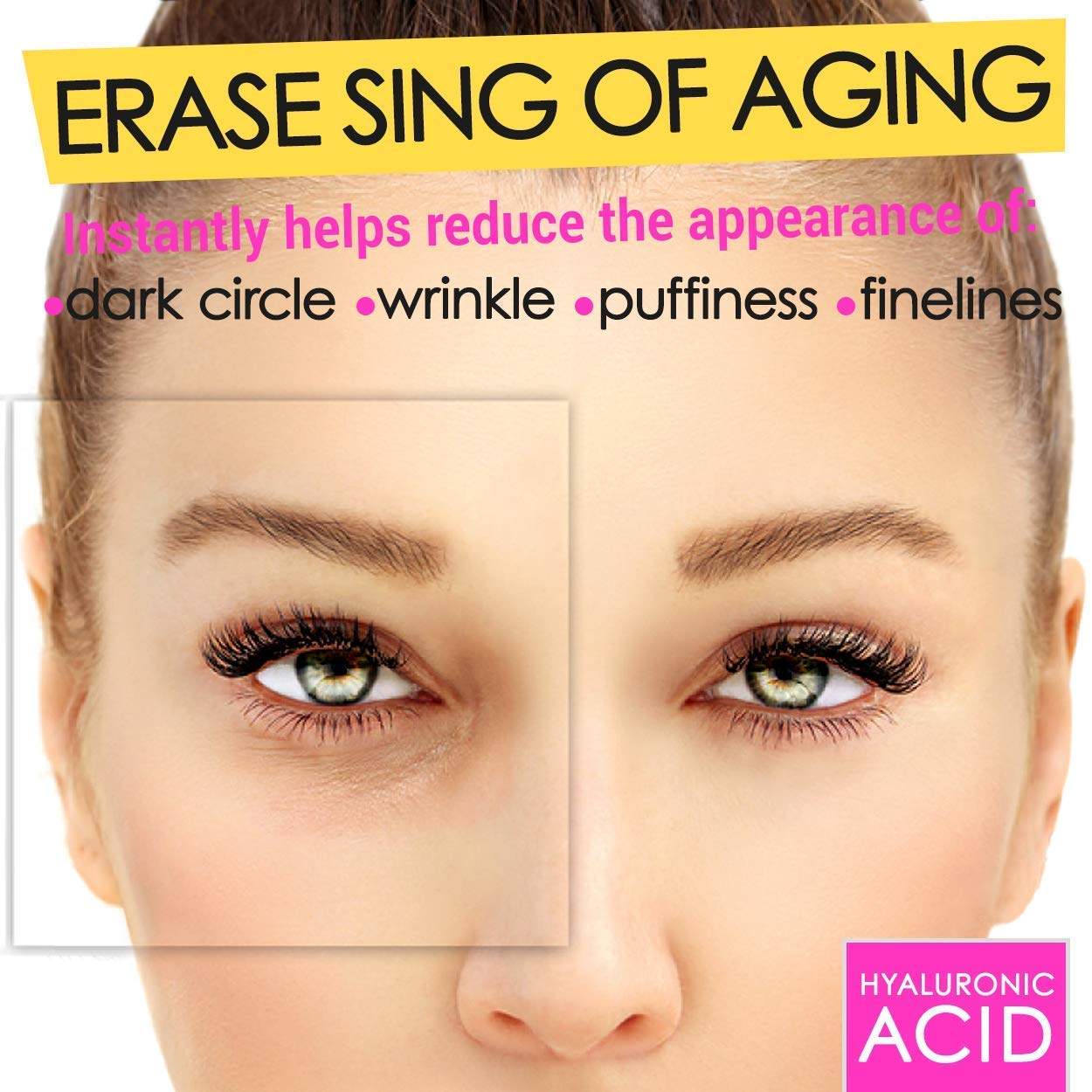 Cedlize Under Eye Collagen Patches, 24K GOLD ANTI-AGING MASK, Pads For Puffy Eyes & Bags, Dark Circles and Wrinkles, With Hyaluronic Acid, Hydrogel, Deep Moisturizing Improves Elasticity, 30 PAIRS : Beauty & Personal Care