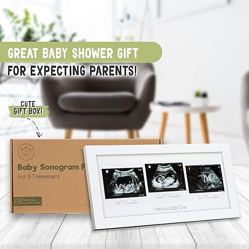 Miniatura 2 de KeaBabies Marco de fotos de triple ecograma para bebé y diario de embarazo, paquete de anuncios de embarazo, decoración de guardería para bebé,