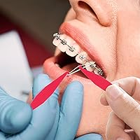 Vista 7 de 30 unidades de bandas elásticas dentales multicolor para aparatos ortopédicos desechables de plástico ortodóncico