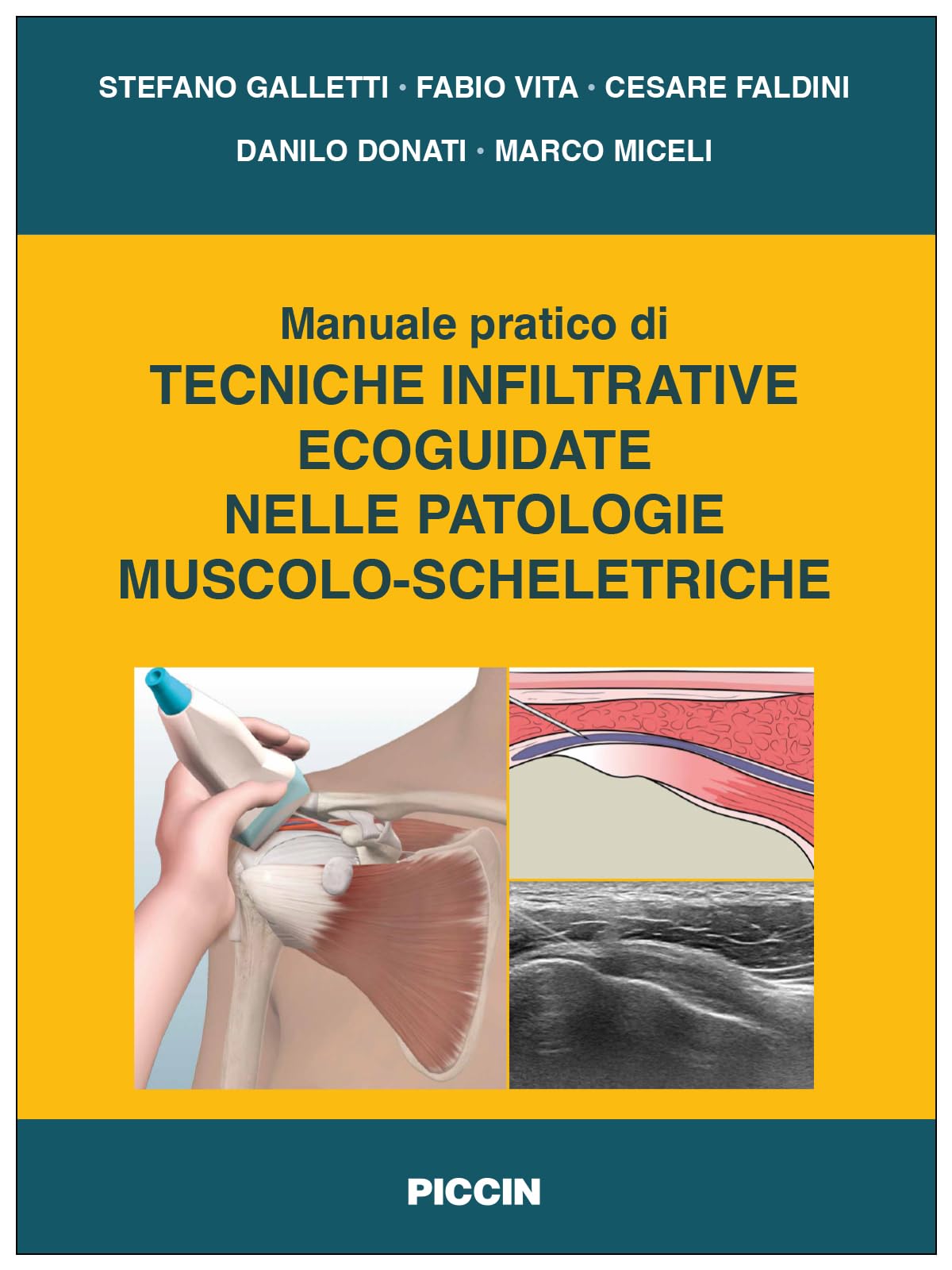 Manuale pratico di tecniche infiltrative ecoguidate nelle patologie muscolo-scheletriche