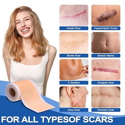 Miniatura 4 de Hojas de silicona para cicatrices y cinta para sustos quirúrgicos, sección C, abdominoplastia  Tiras de tratamiento de golpes queloides  Rollo de