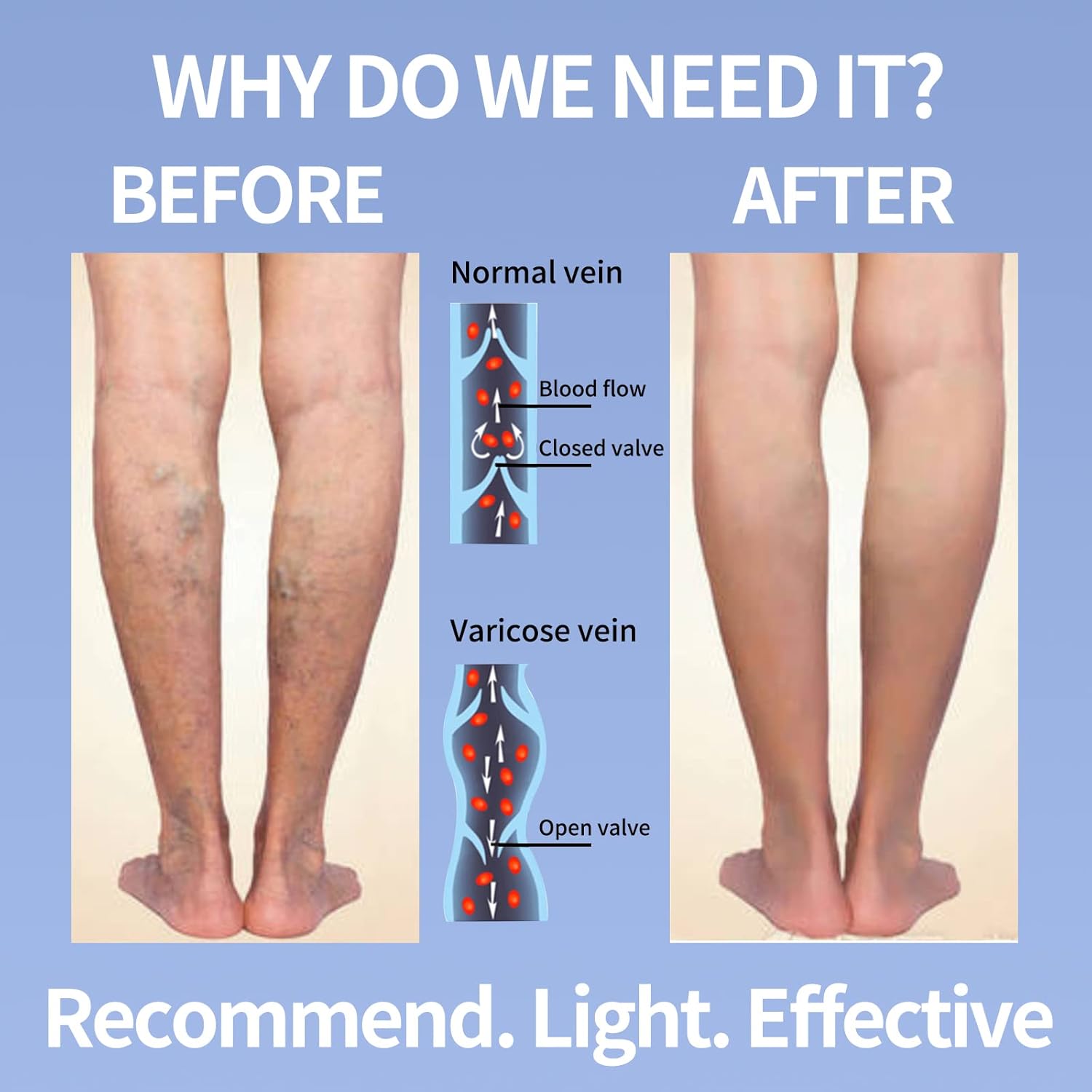 Open Toe Compression Socks for Women Men 15-20 mmHg 4 Pairs Toeless Footless Socks Compression - Image 4