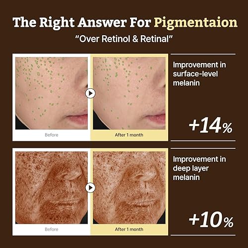 Miniatura 5 de Dr. Reju-All Advanced Retino-Mela Serum - Suero de retinol HPR para la cara - Anti-envejecimiento, minimizador de poros, cuidado de la piel coreano