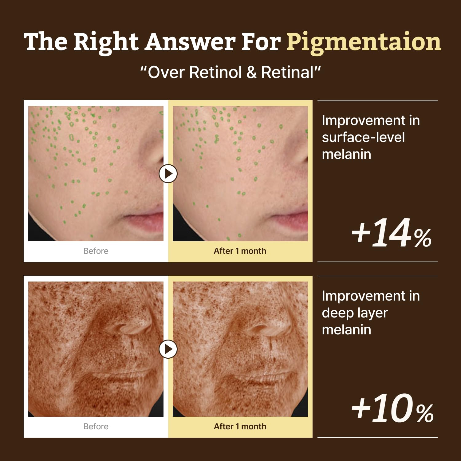 Dr. Reju-All Advanced Retino-Mela Serum – HPR Retinol Serum for Face – Anti-Aging, Pore Minimizer, Next-Gen Korean Skin care – Gentle & Beginner-Friendly – Niacinamide 10% & TXA 4% – 1 Fl Oz