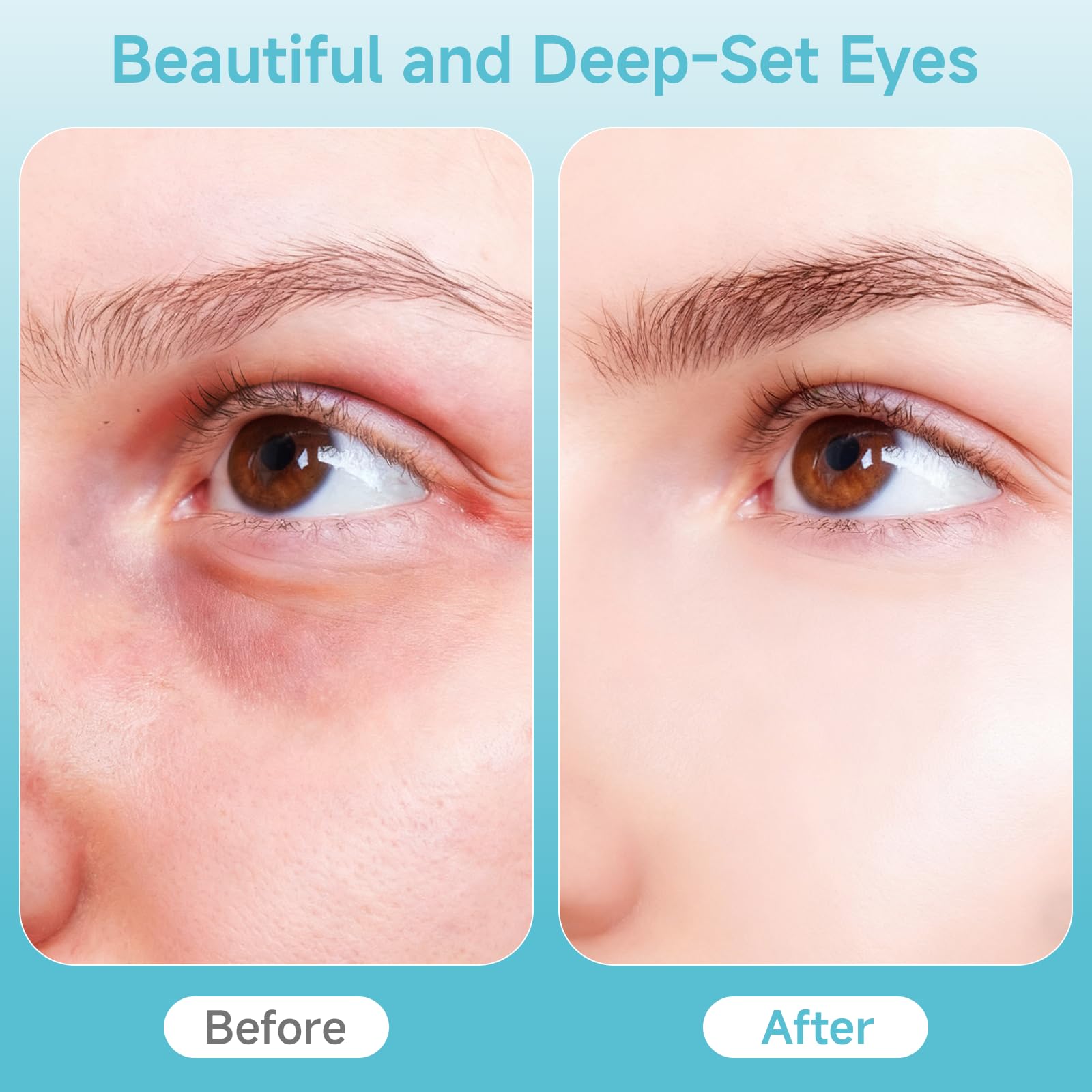 Depuffing Wand for Eyes & Face, 2-in-1 Hot & Cold Eye & Facial Massager
