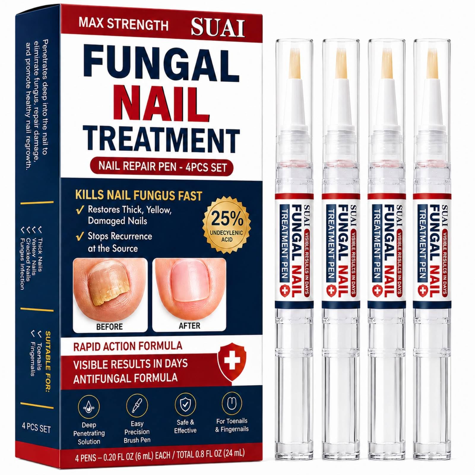 Fungus Nail Treatment Pen, 25% Undecylenic Acid for Thick, Yellow Nails Red 0.8 Fl Oz (Pack of 1)