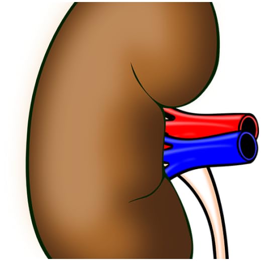Kidney Disease Diet