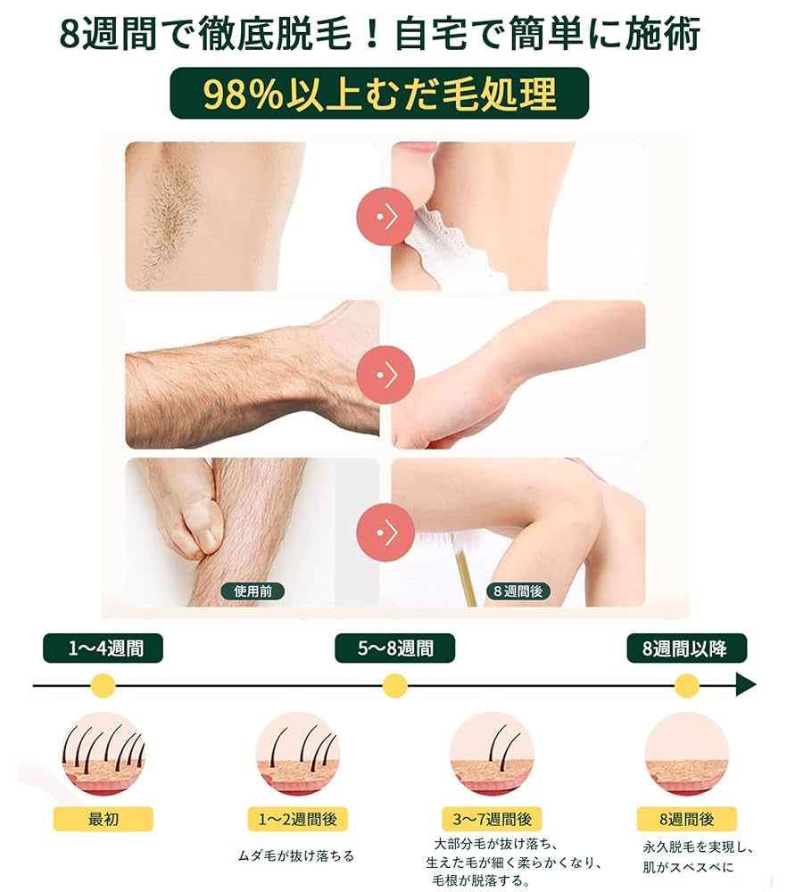 レーザー脱毛器 KAHE 脱毛器 Amazon | KAHE 脱毛器 全身脱毛 冷感脱毛 IPL光脱毛器 5段階調節