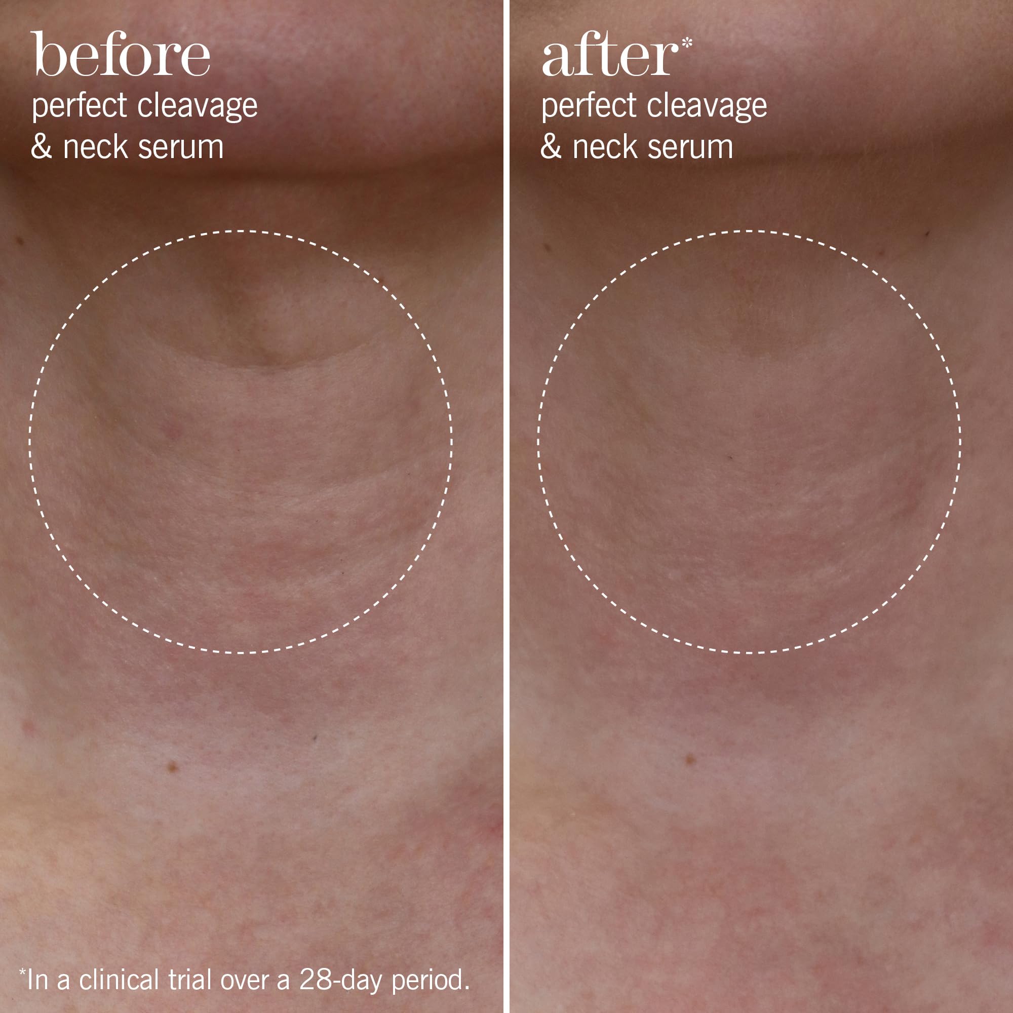 This Works Perfect Cleavage & Neck Serum, 150 ml, hidratante antienvejecimiento para cuello y escote con algas marinas y ácido hialurónico, crema de cuello que estimula la juventud con aceites