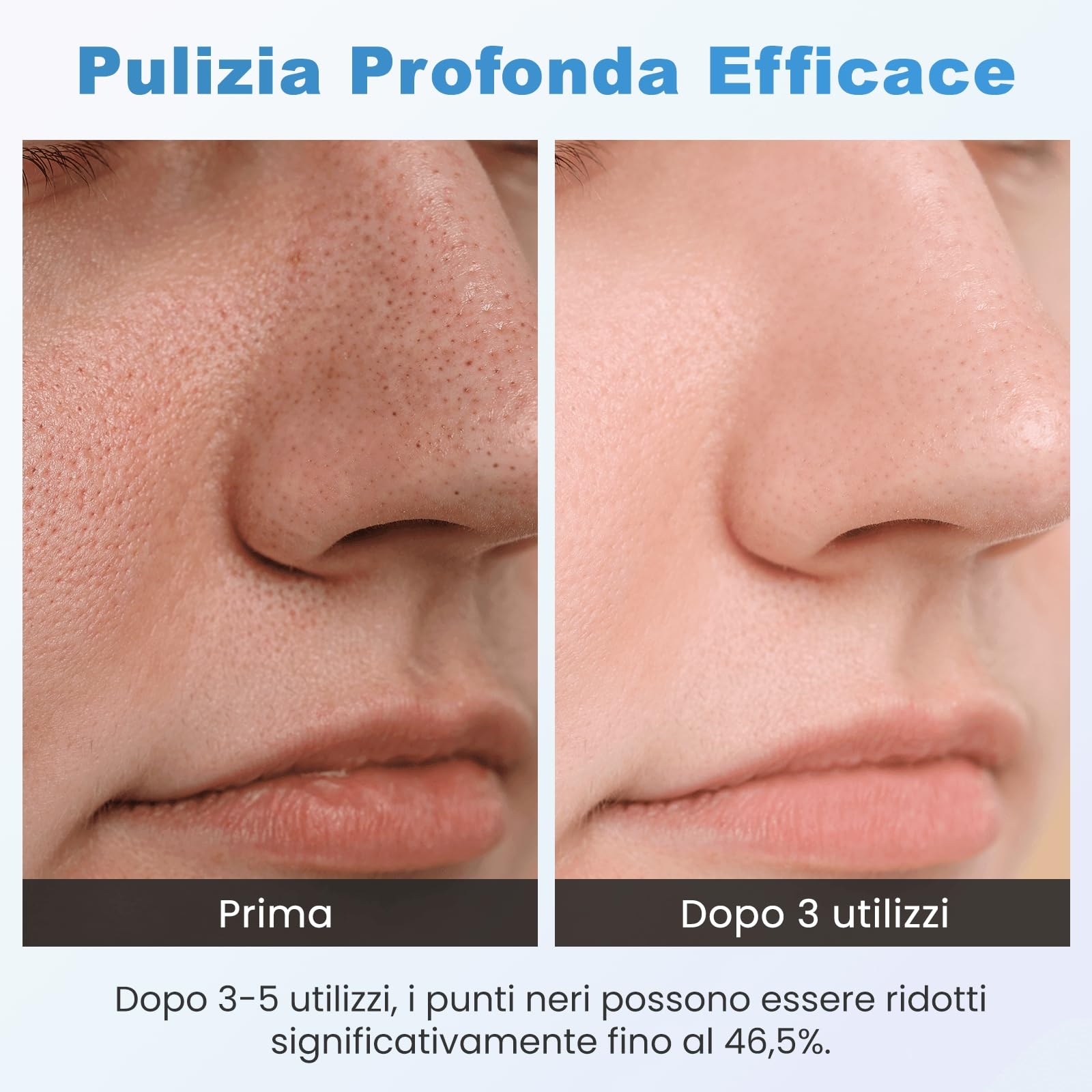 Aspiratore Punti Neri Professionale, Lrbsule Aspiratore Punti Neri Rimozione dei Grassi 6 Testine per Estrattore 3 Modalità di Aspirazione, Ricarica USB Blackhead Removal