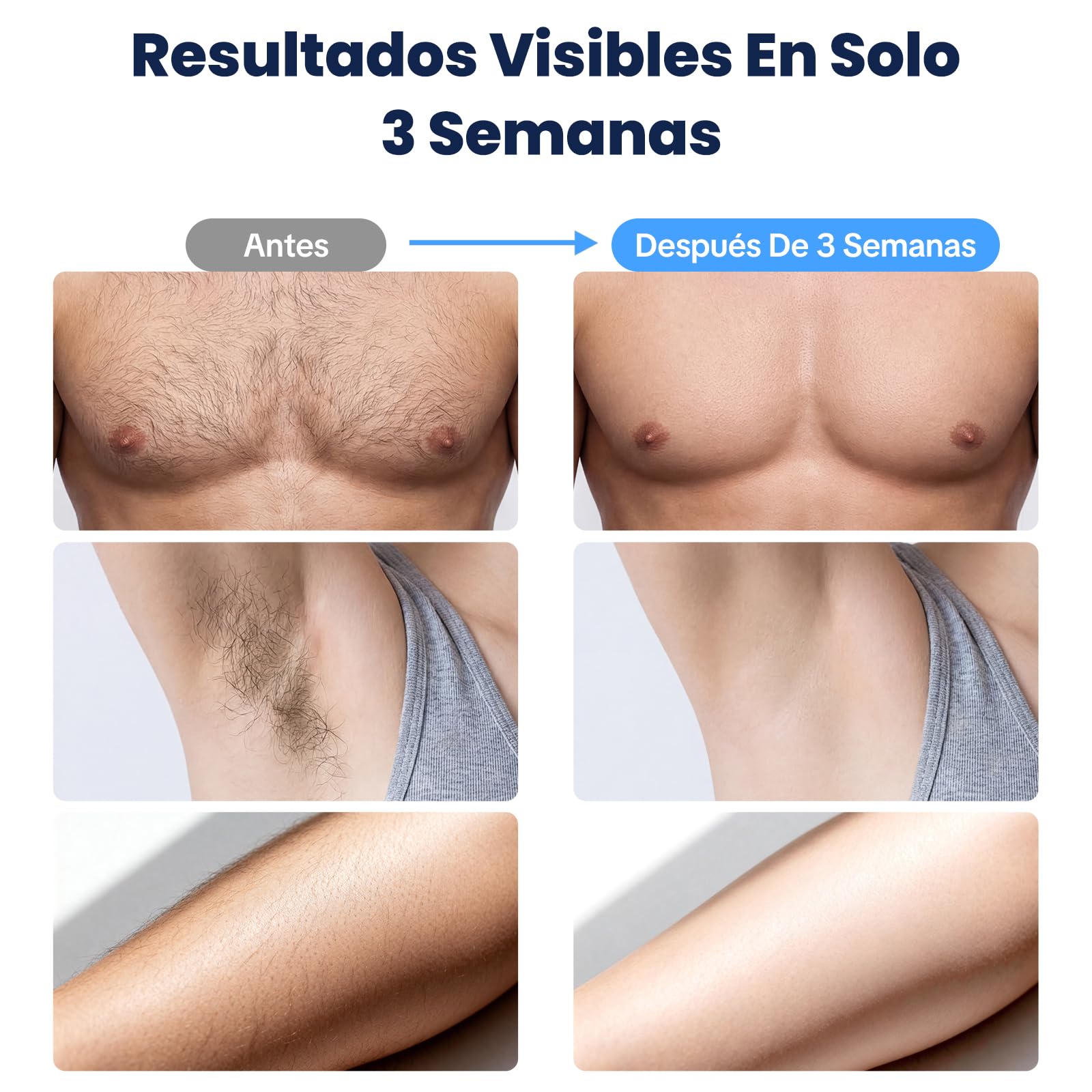 MANKIW Depiladora IPL Luz Pulsada con Enfriamiento, 500000 Pulsos | Depiladora IPL con enfriamiento, 5 niveles y 500000 pulsos para piernas, axilas, bikini y uso cómodo en casa