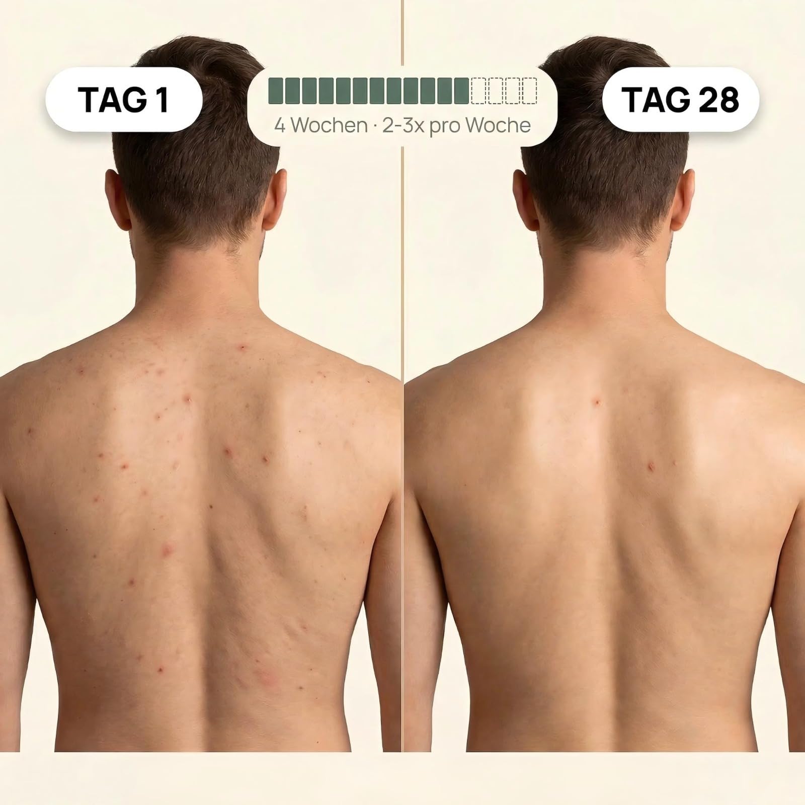 Duschtuch Peeling - Hammam Peeling-Duschtuch, Rücken Körper Peeling Duschtuch für Männer Frauen, Echte Tiefenreinigung in 3 Minuten (1 Pcs Schwarz)