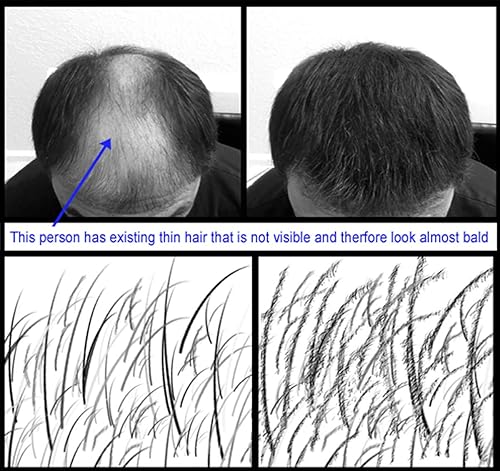 Miniatura 2 de para cabello adelgazante - Fórmula natural 100% indetectable - Oculta completamente la pérdida de cabello en segundos. Cubre las calvas. Espesa tu