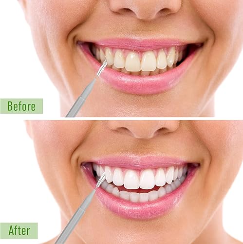 Miniatura 5 de Patelai 100 piezas de cepillos para limpiador, cepillo interdental, palillo de dientes, cabezal de hilo dental, hilo dental, higiene dental, hilo