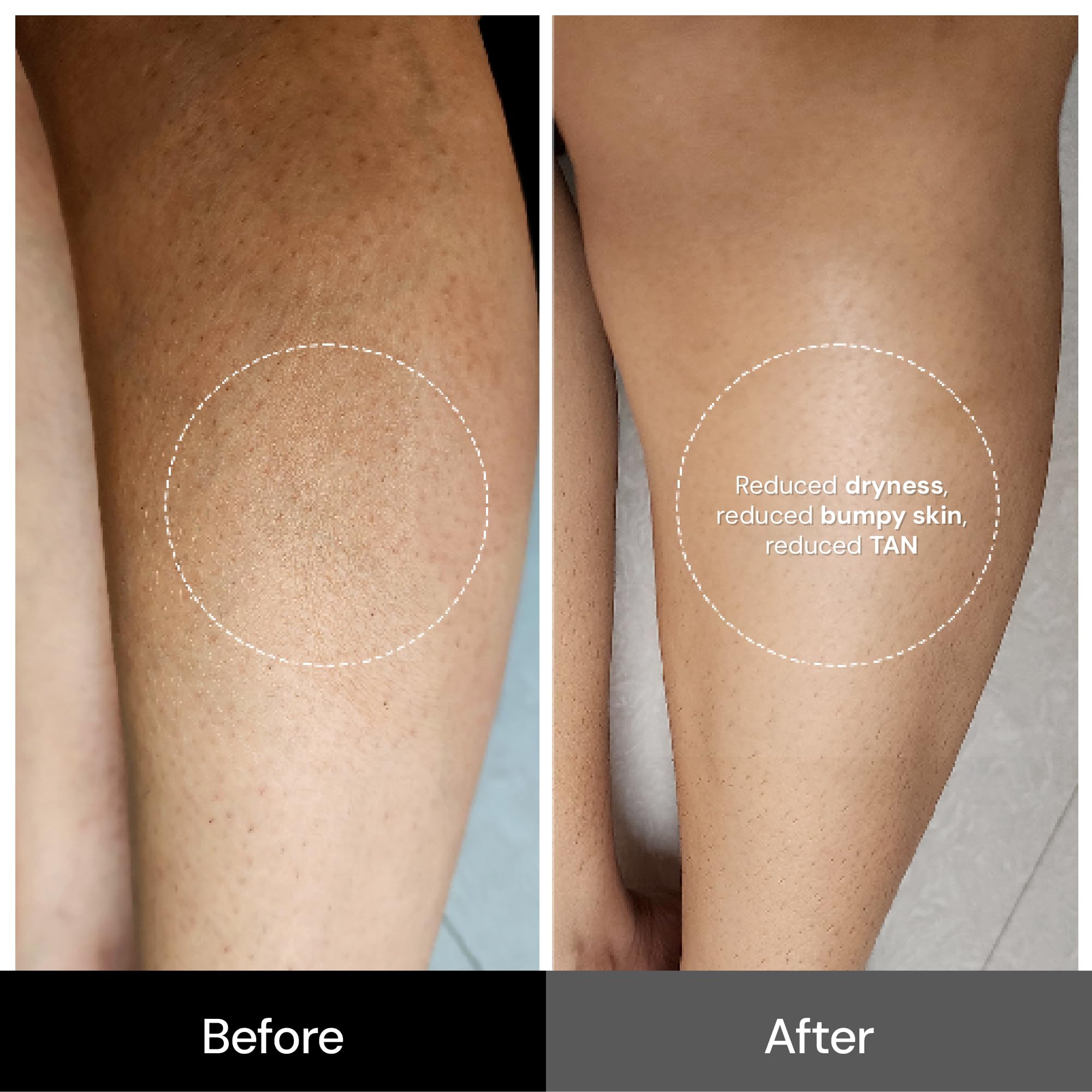 SUGANDA SKINCARE 5% Lactic acid UNSCENTED EXFOLIATING Body Lotion|Moisturizer with NIACINAMIDE, SHEA BUTTER & CALENDULA|For STRAWBERRY SKIN improving SKIN-TEXTURE & BRIGHTENING (500ml)|Cruelty-free 4