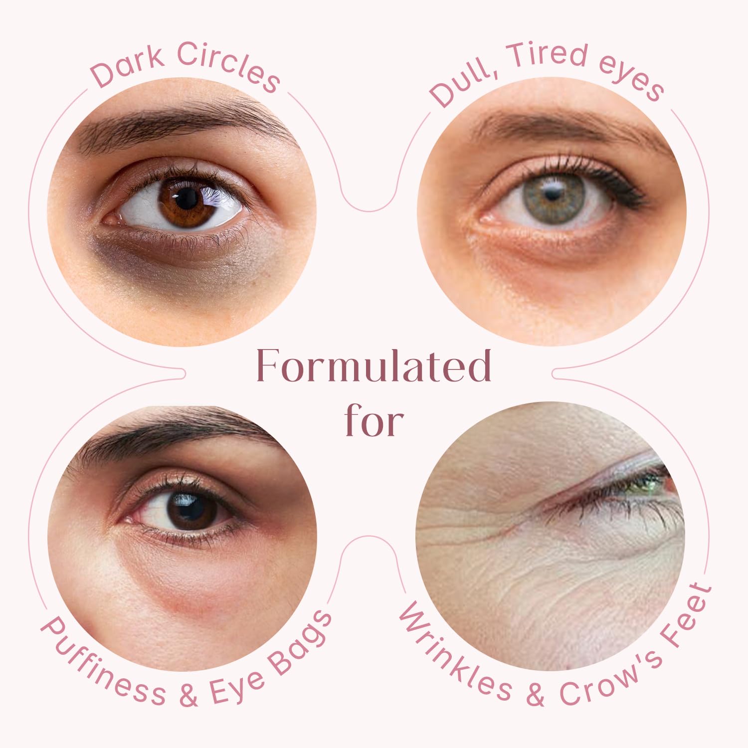 Seoulskin under eye cream | dark circles removal for women and men | Under Eye Gel to Reduce Dark Circles, Puffiness & Wrinkles With Built-in Cooling Massage Roll-On Applicator | 5% Niacinamide, 2% Alpha Arbutin | 15 ml — Amazon image 3