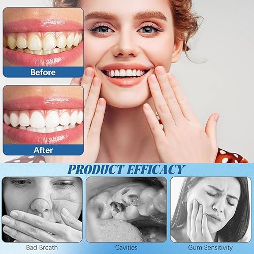 Miniatura 4 de 2 piezas de reparación odontica nudenta, líquido de armadura dental curativa de caries, complejo de remineralización de nano hidroxiapatita para