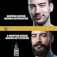 Vista 8 de Aceite de crecimiento de barba de minoxidil al 5%, 2 onzas