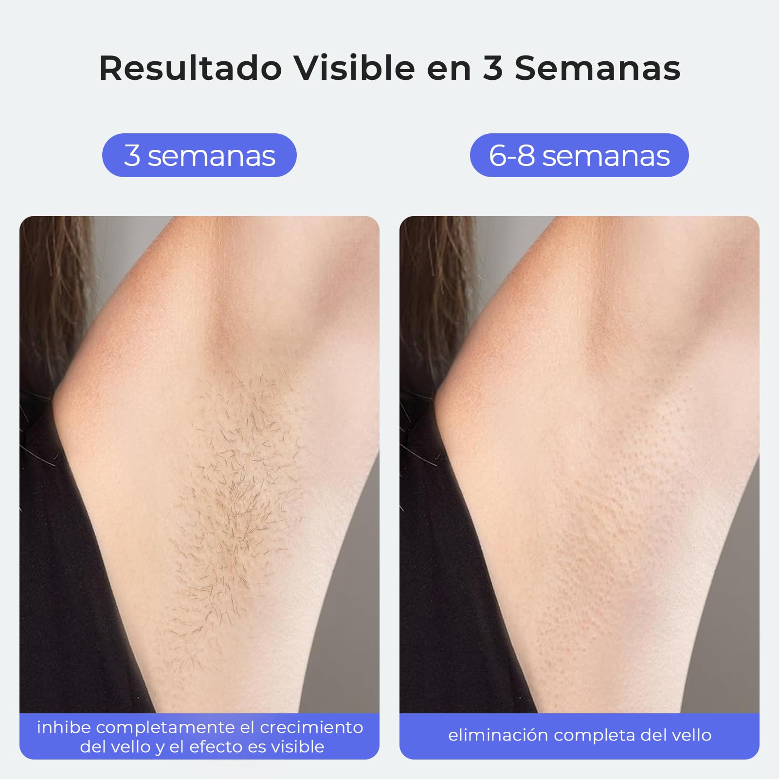 Depiladora Luz Pulsada, IPL Sapphire Indolora Depiladora Laser para Mujeres y Hombres, Con Funda, Enfriamiento Efecto Hielo, para Piernas, Bikini, Axilas, Cara, Cuerpo