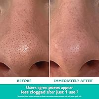 Vista 4 de Peter Thomas Roth Purificador exfoliante de poros de microdermoabrasión Even Smoother™