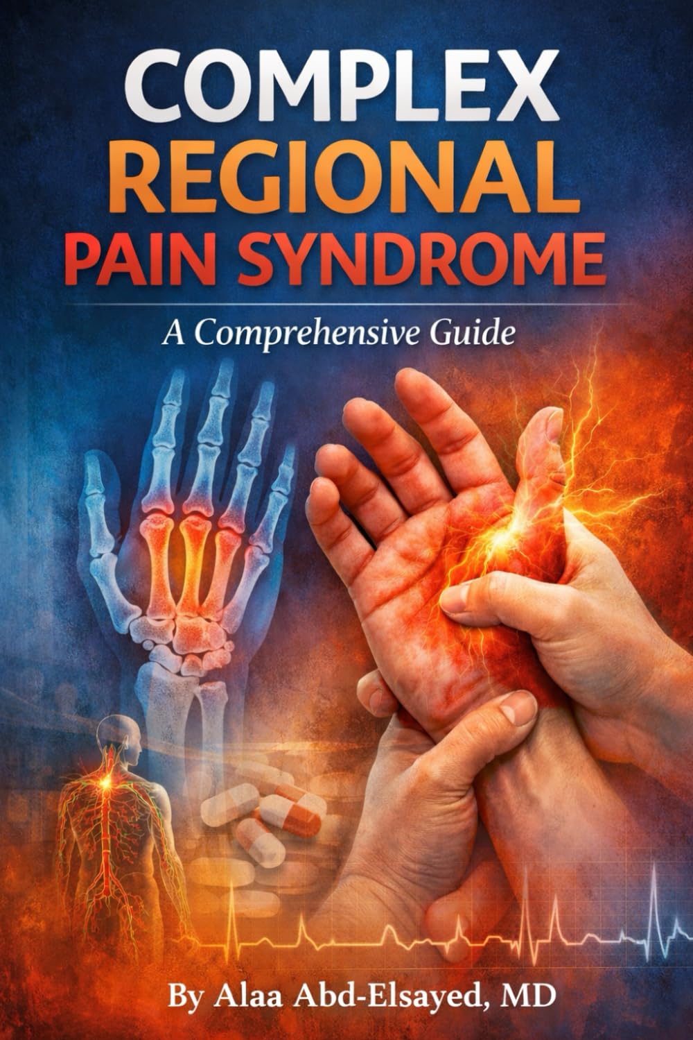 COMPLEX REGIONAL PAIN SYNDROME: A COMPREHENSIVE GUIDE