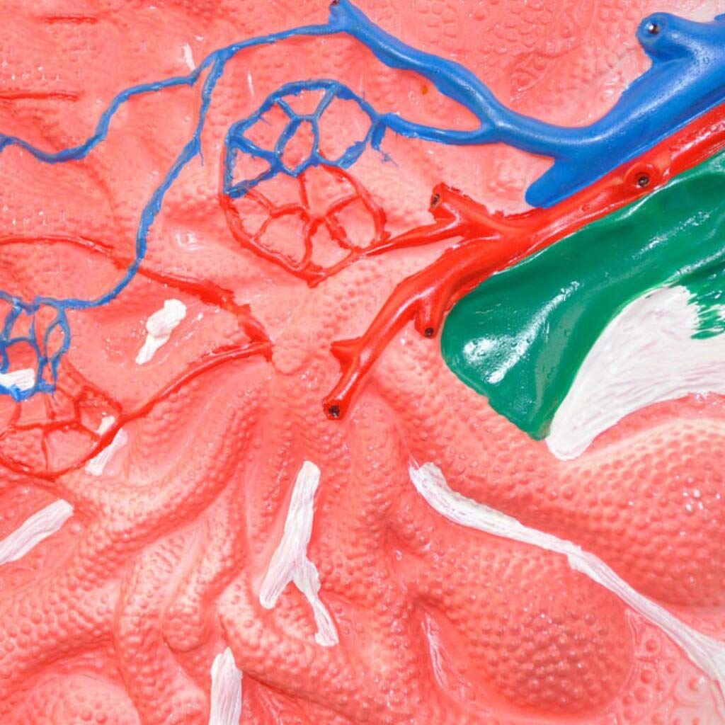 Modello di linfonodo, Modelli scientifici di Anatomia Umana - Modello anatomico di Pittura avanzato per Display di studi scientifici, Attrezzatura di Laboratorio per la Formazione degli studen