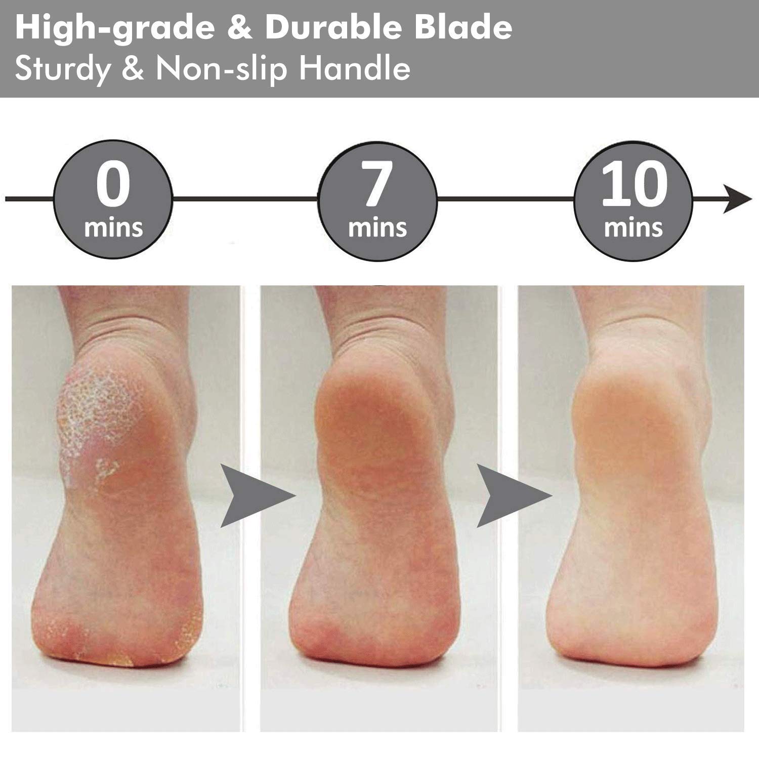 ZORBES Stainless Steel Rasp Callus Filer Blade Foot Care Foot Scraper, Easy Use and Clean, Callus File for Wet and Dry Feet (Pack of 1, Black) 2