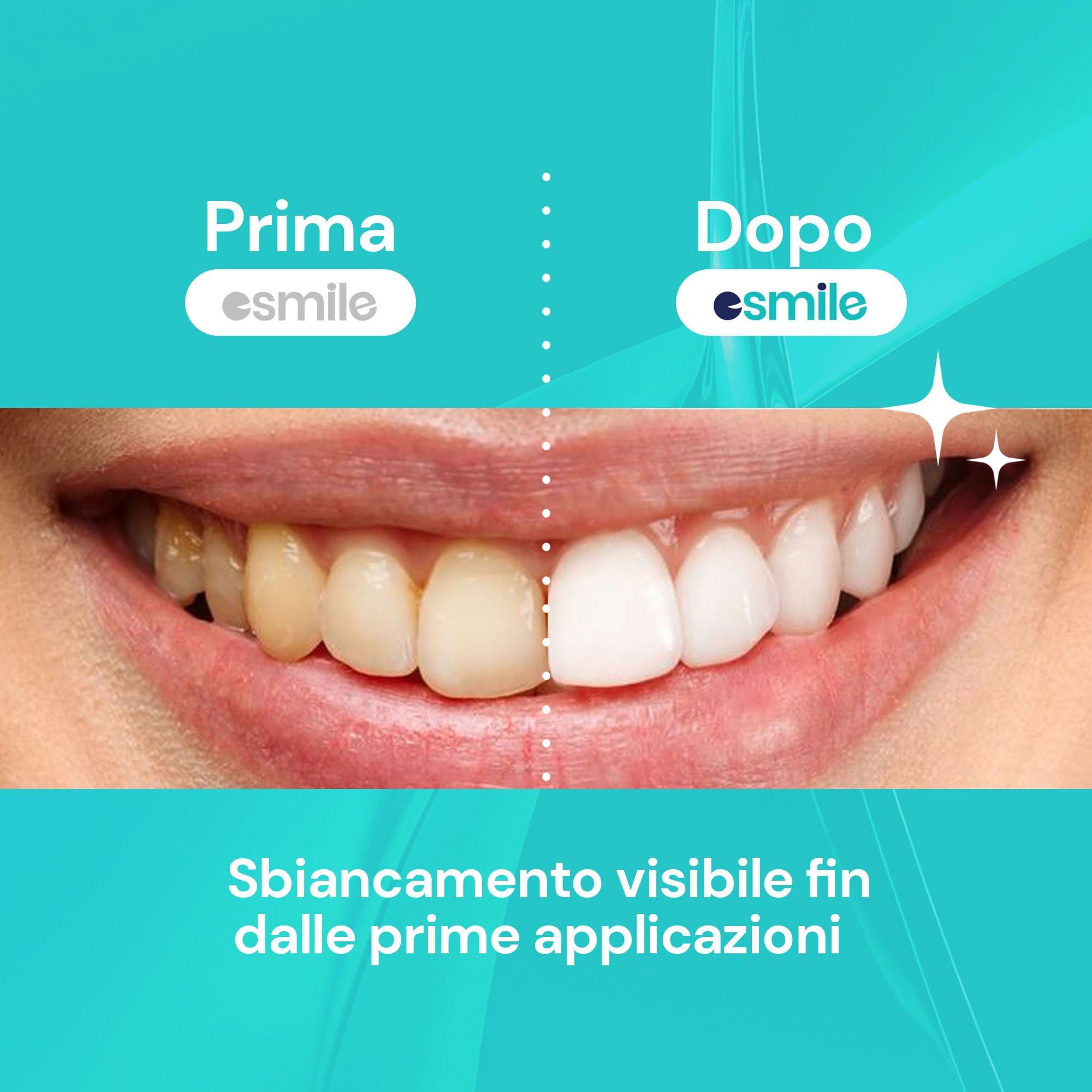 ESMILE Polvere Sbiancante Denti Immediato - Carbone Attivo Naturale al gusto di Menta per uno Sbiancamento Professionale - Pasta per Denti Bianchi (-, Carbone Attivo)