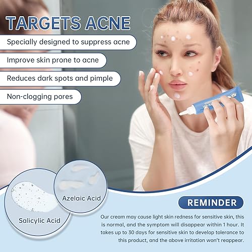 Miniatura 4 de Crema de ácido azelaico 14% para aliviar el enrojecimiento, manchas oscuras, suero facial con niacinamida y vitamina C previene brotes de acné,