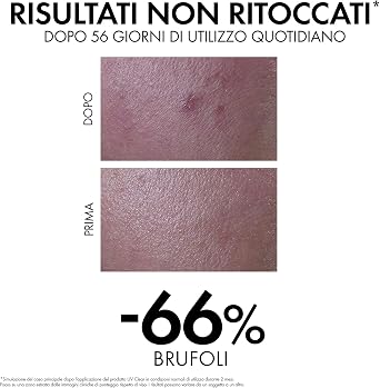 VICHY Capital Soleil Uv Clear Spf50 Yağlı Ve Akneye Eğilim Gösteren Ciltler Için Güneş Koruyucu 40m