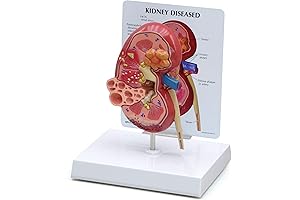 Realistic Kidney Model for Comprehensive Anatomy Education