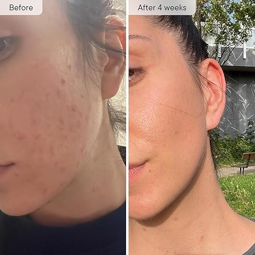 Miniatura 5 de Qure Skincare - Grifo de agua con filtro para lavabo de baño para la piel, reduce el 99% del cloro y metales pesados, hidratación de la piel en 4