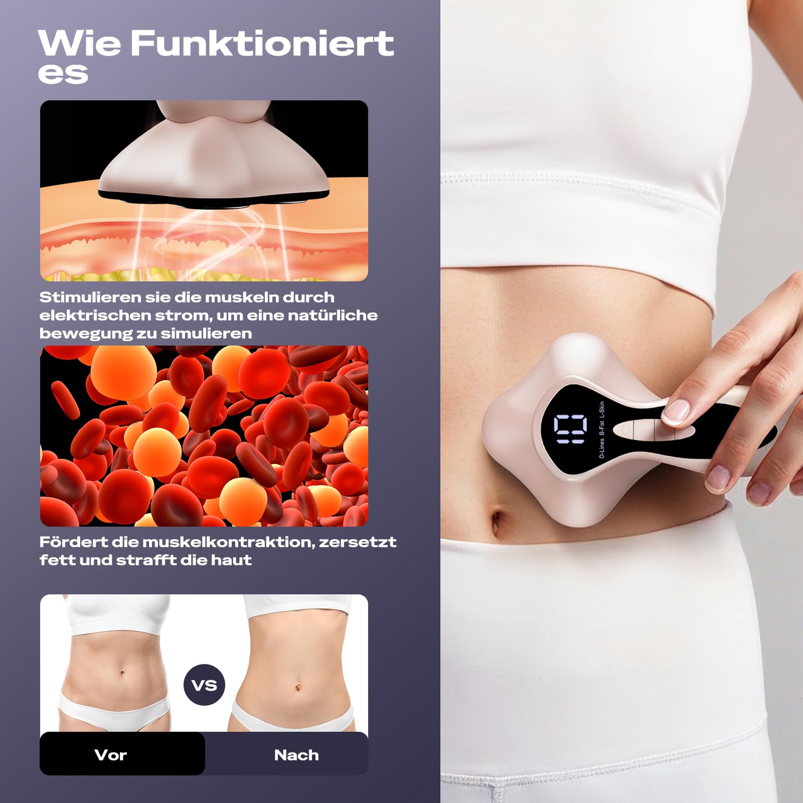 Cellulite Massagegerät, Anti Lipödem Handmassagegerät, Nachgewiesene Wirksamkeit, Kabelloses AntiCellulite Massagegerät mit 4 Massageköpfen,Geeignet für Bauch, Taille, Arme, Beine(Roségold)