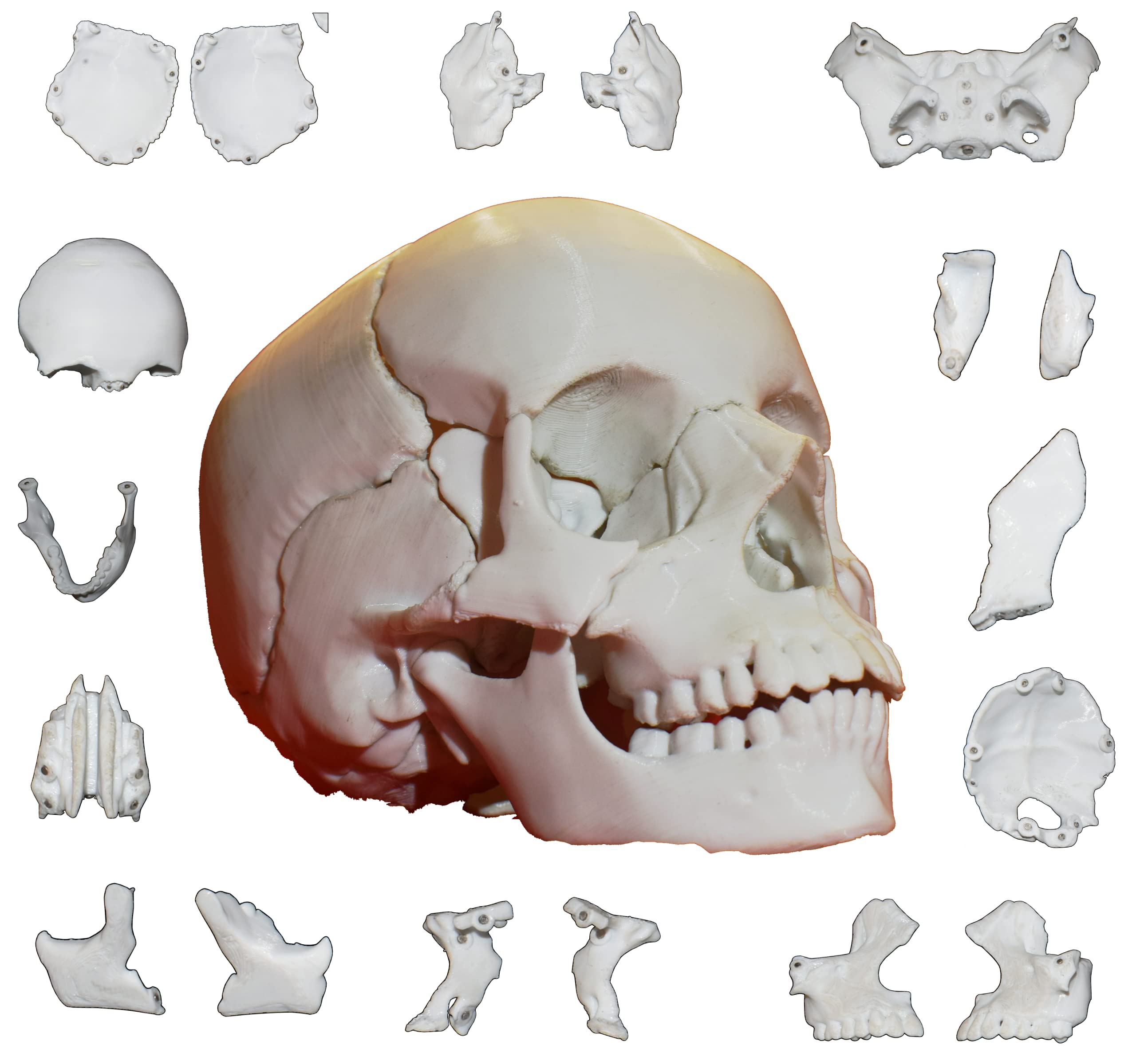 Human Skull Model for Medical Students with Separable Frontal, Occipital, Parietal, Temporal, Palatal, Maxilla, Inferior Nasal Concha, zygomatic, Mandible, Vomer, Sphenoid & Ethmoid Bones (B0CLRM74PG) Amazon Price History, Amazon Price Tracker