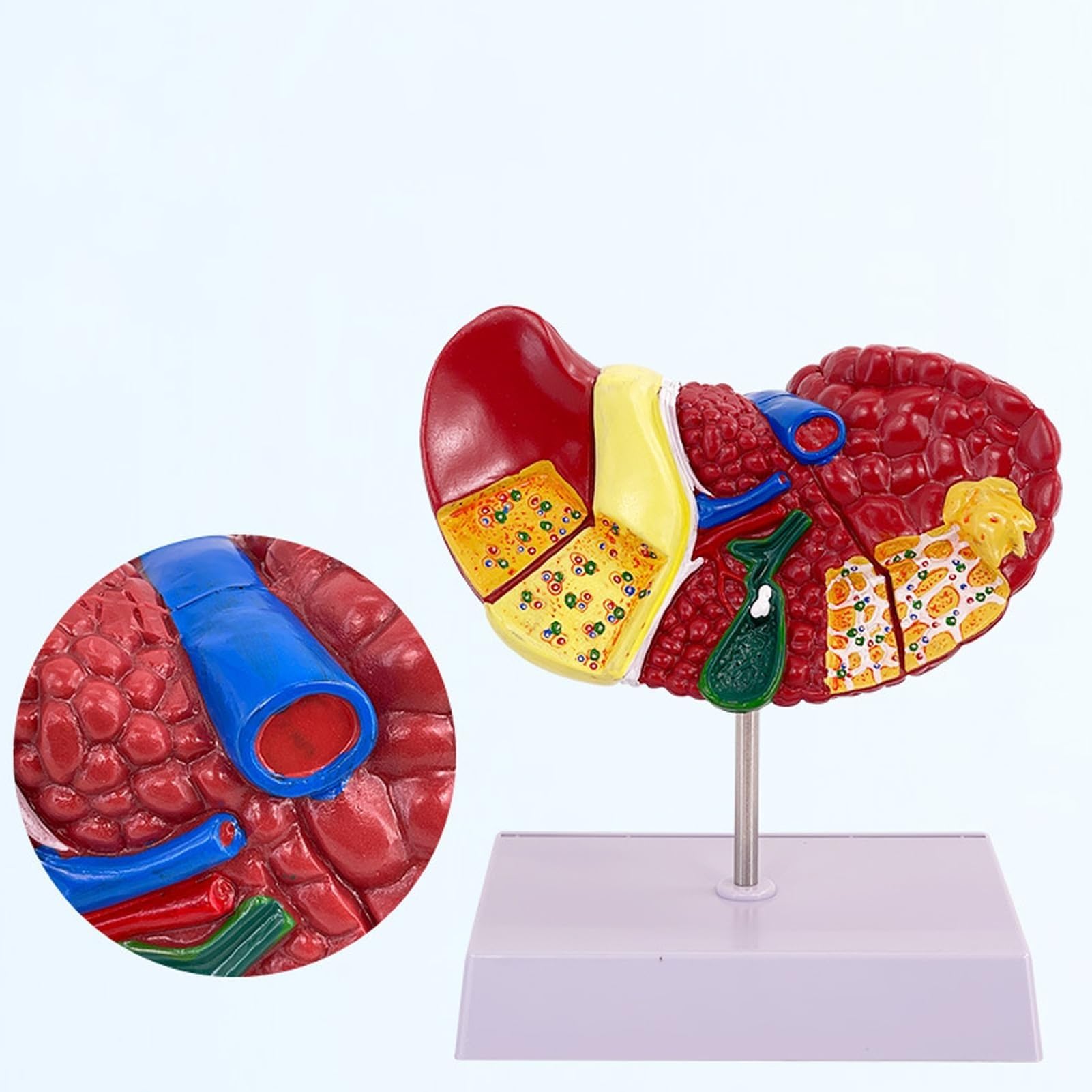 Xiaoxu 1:1 Liver Anatomical Model Pathological Liver Model Clear Texture Obvious Pathological Features with Base, for Doctor Office Anatomy Model School Teaching Display