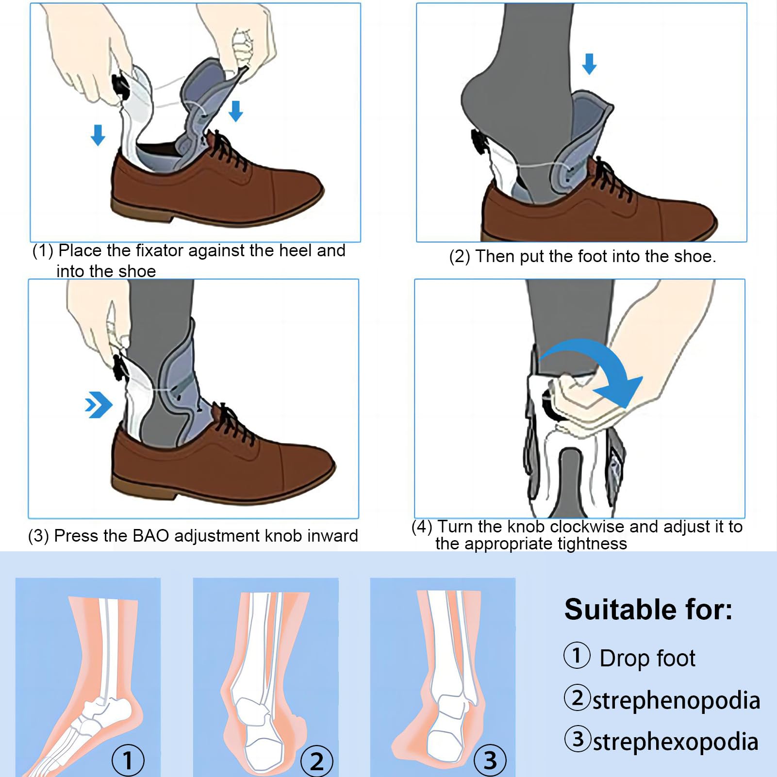 Attelle AFO pour Pied Tombant – Orthèse de Cheville et Pied réglable pour AVC, paralysie nerveuse, hémiplégie – Attelle légère et Confortable pour Usage Quotidien
