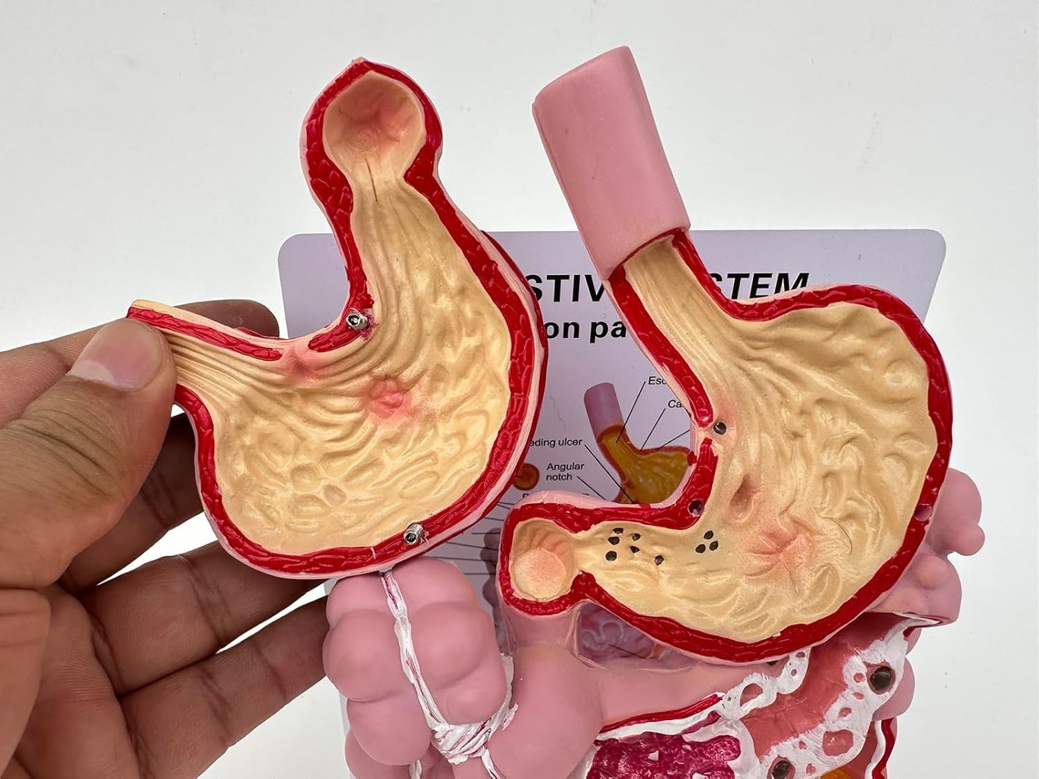Model układu pokarmowego człowieka, model dydaktyczny przekroju żołądka, wyjmowany model anatomii ludzkiego żołądka, obejmuje przewód pokarmowy i okrężnicę, odpowiedni do wspomaganej nauki.