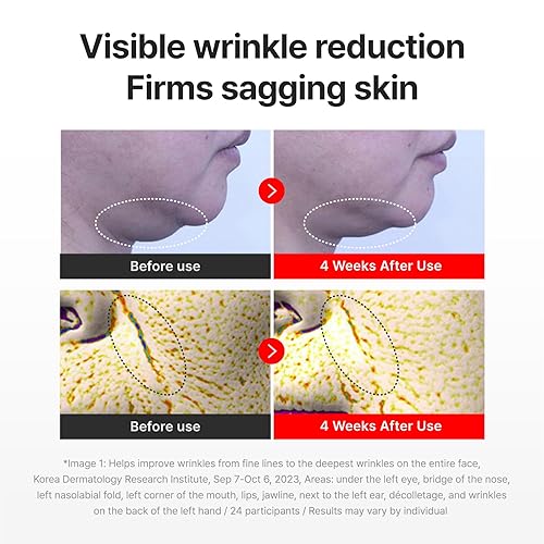 Miniatura 3 de CENTELLIAN 24 Crema Madeca Time Reverse 50ml + Máscara Madeca Derma 3(Intensiva) 10 piezas Set hidratante, reafirmante, antiarrugas con centella